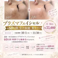 プラズマフェイシャル※60日間受け放題集中ケア