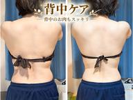 🌸美容整体コース｜バストアップ×ウエスト・背中痩身ケア（セット）