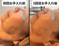 ⭐ 温感ほぐし × 筋肉ケアで整えるプレミアムフェイシャル（120分）