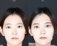 【COSMETIC LASH LIFT & EYE BROW STYLING PERM】