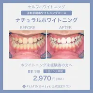 【初回限定】自然な歯本来のピカピカの白さを目指していきます😁〈30分照射コース〉