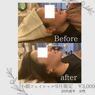 【27.28日限定】［ビフォーアフターの写真OKな方］ems付き小顔矯正マッサージ40分¥6,800→¥2,900