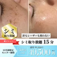 💎シミ取り放題15分