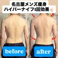肩から腰の疲れにハイパーナイフで揉みほぐしと温めリンパや老廃物も流れ整体&マッサージいらずに!