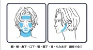 ヒゲ脱毛全顔