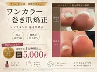フット🩰💫ワンカラー(マグネット・フラッシュ変更🉑+1100円)+巻き爪矯正(レジスタンス)🫧
