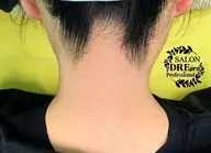 うなじWAX