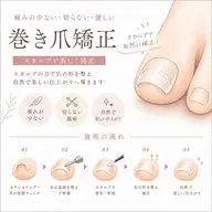 💅巻き爪矯正【両足】プラスしてフットジェルのメニューも🉑
