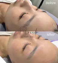 フェイシャルWAX＋アイブロウWAX(お仕上げメイク付き)