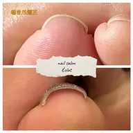 巻き爪矯正フットネイル