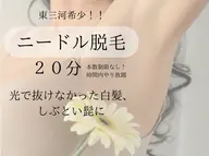 話題のニードル脱毛【20分】美容電気脱毛