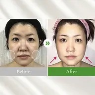 【8/12,14限定🌸】小顔整体コルギ、小顔矯正の練習台になってくれる方募集‼️※募集時間は詳細に！