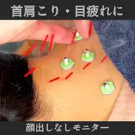 【顔出しなし・女性限定】首肩こり鍼|SNS撮影モニター30分