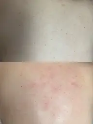 背中Wax✨