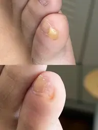 副爪2本