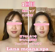 ご新規様🧡当店一押し🧡リピート様が続出!🎀小顔美容矯正&(光)フェイシャルエステ🎀もっと早く知りたかった..!!