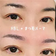 HBL
