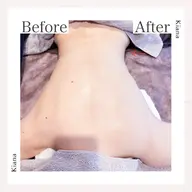 💎全身スリムコース💎 RF &クラッシュ吸&ハンド 施術80分