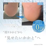 足裏角質ケア
