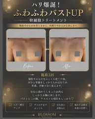 (補正下着なし!)ハリ誕生ふっくらバストUP⭐︎エアジェットトリートメント