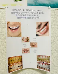 歯のホワイトニングセルフ