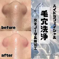 人気No1✨🫧全顔毛穴洗浄🫧毛穴汚れしっかり除去⏰60分