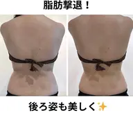 ❤️痩身❤️🉐かけ放題🉐【痩身迷ったらこれ】全身キャビORハイパー+痩身アロマリンパ💚 150¥11800