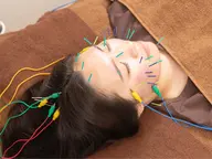 【30代オススメ】むくみ・フェイスライン集中◎美容鍼60分【小顔・女性専用・浦和】11,000円