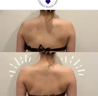 【口コミ+掲載写真必須】ハイパーナイフEX上半身スタイルアップ60分!
