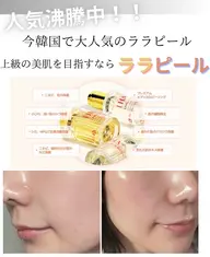 ミニモ会員様限定‼️韓国人気注目のララピール　LHALA PEEL
