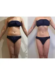 【グランプリ施術体験】温活リンパ痩身|ボディメイク(150分)