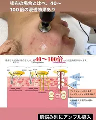 【毛穴レス&肌トラブル別ケア】毛穴洗浄+お悩み別で選べるイオン導入(70分)