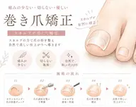 Jrメニュー💅巻き爪矯正【両足】
