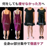 【ダイエット】驚異の結果重視痩身術！まずは体験してみて♪¥33000→¥16500