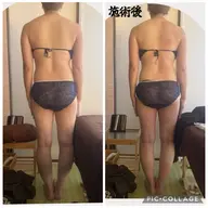 夏までにむくみすっきりケア