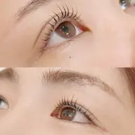 マツパ