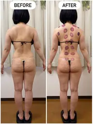 撮影モニター募集❗️よもぎ蒸し30分+上半身マッサージ60分