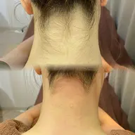 【うなじWax】モニター募集♪残り5名で終了‼︎ 髪をUPにする事が多いこの季節✨ うなじをキレイにしませんか