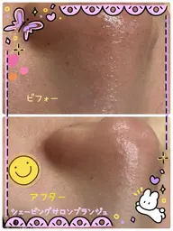 【毛穴・角質ケア】美肌シェービング+炭酸ヘッドドライスパ