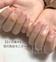 【限定モニター募集】深爪矯正 6回集中育成コース
