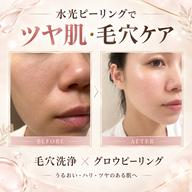 【ミニモ限定】水光ピール毛穴洗浄フェイシャル60分(小顔リフト付き)