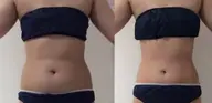 【上半身or下半身orさくっと全身】90分🔥オーダーメイド痩身🤎