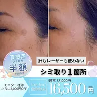 💎シミ取り1箇所(1cm×1cm)
