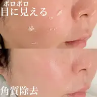 5月限定20%OFF★酵素ピーリング角質ポロポロ★天然由来成分でダウンタイムなし！
