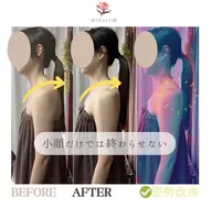【首・肩凝り/巻き肩】が顔の大きさの原因かも😣姿勢から整えてスッキリ小顔へ導きます ¥20,900→¥3,300