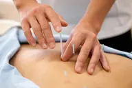 腰痛の鍼施術➕マッサージ
