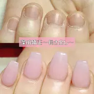 【深爪矯正】スカルプで長さ出し(カラー付)