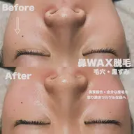 【まつ毛パーマ・小鼻WAXセット】