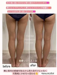 筋膜リリース120分