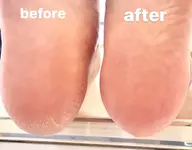 かかと、ヒールダコの角質ケア🫧